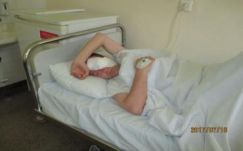 Elveszítette egyik szemét, gyűjtenek egy csíkszeredai fiatalembernek