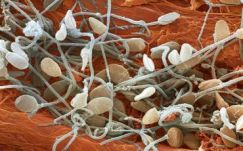 Egyre kisebb a nyugati férfiak spermiumszáma