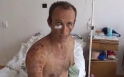 Csíkszentléleknél támadt  újra a medve, az áldozatot műtik