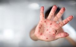 Szinte 9 ezer kanyarós esetet regisztráltak eddig az országban, 45-öt a héten