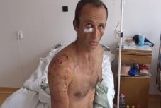 Gyűjtenek a medvetámadások áldozatainak megsegítésére Hargita megyében