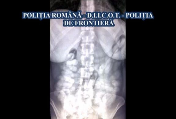 Hatalmas drogfogás Otopeni-ben: két kiló kokaint rejtettek el a gyomrukban