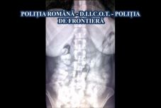 Hatalmas drogfogás Otopeni-ben: két kiló kokaint rejtettek el a gyomrukban