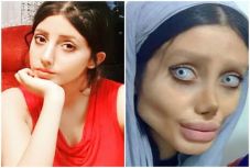 Ötvenszer feküdt kés alá, hogy példaképéhez hasonlítson. Sikerült?