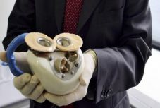 Teljes műszívet kapott egy 58 éves férfi Prágában