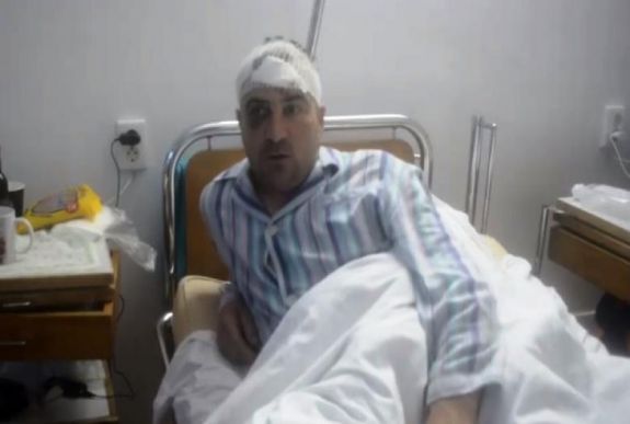 Újból emberre támadt a medve Hargita megyében