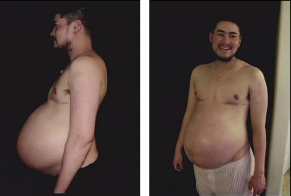 Nem jegyzik be anyaként a német spermadonor, transznemű nőt