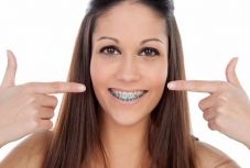 „A fogszabályozás kicsit olyan, mint a fogyókúra” – dr. Kiss-Lőrincz Géza fogorvos tanácsai