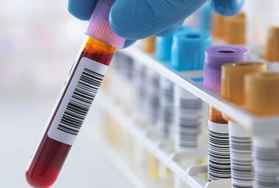Ausztria segítené Romániát az immunglobulin-hiány kiküszöbölésében