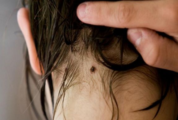 Hamarosan kezdődik a kullancsszezon