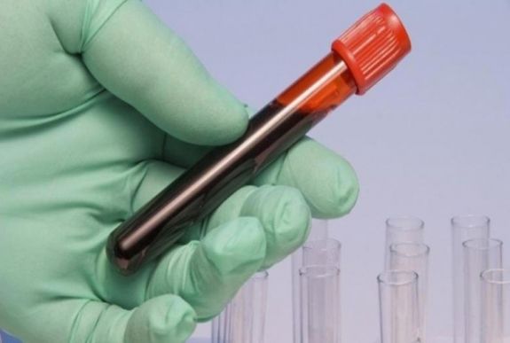 Két héten belül tízezer adag immunglobulin érkezik az országba