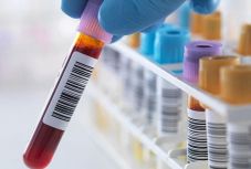 Ausztria segítené Romániát az immunglobulin-hiány kiküszöbölésében