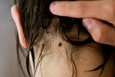 Hamarosan kezdődik a kullancsszezon