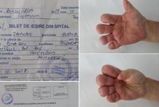 Brassói plasztikai sebész a betegéről: bárcsak amputáltam volna a kezét