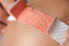 Kifejlesztették a kötszert, amellyel harmadával gyorsabban gyógyulnak be a sebek