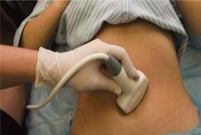 Mesterséges petefészket fejlesztettek dán orvosok