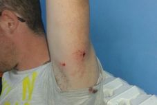 FRISSÍTVE - Részletek derültek ki a tusványosi medvetámadásról