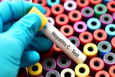 A hepatitiszeseknek csak harminc százaléka tudja, hogy beteg