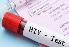A HIV-fertőzés megduplázza a szívbetegség kockázatát