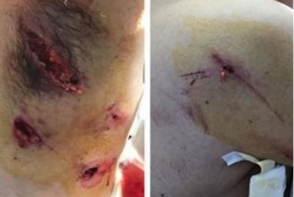 Medvetámadás: ülésezik a Sürgősségi Esetek Hargita Megyei Bizottsága