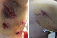 Medvetámadás: ülésezik a Sürgősségi Esetek Hargita Megyei Bizottsága