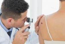 Fontos évente ellenőriztetni az anyajegyeket