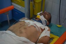 Újabb medvetámadás Hargita megyében: súlyosan megsebesült az áldozat