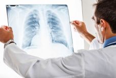 Ennyien haltak meg Romániában rákbetegségben