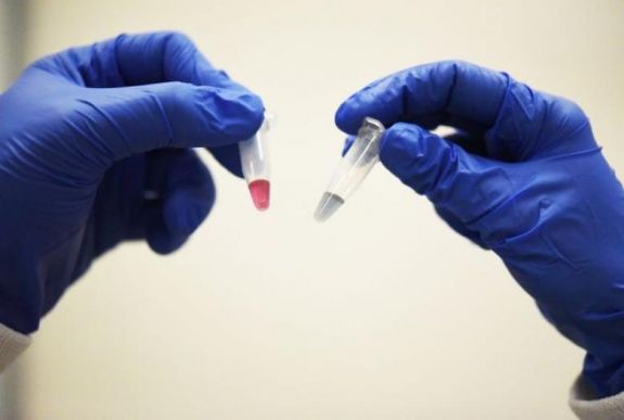 Egy új teszt 10 perc alatt, 90%-os pontossággal kimutatja, ha valaki rákos