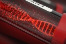 Már a tünetek előtt jelzi az Alzheimer-kórt egy vérvizsgálat