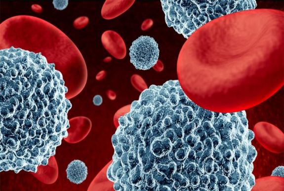 Az immunterápia tartós eredményre vezet a rákbetegek egy részénél