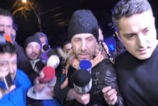 Üszkösödő mellbimbó: jelentkezett az álsebész egyik áldozata