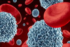  Az immunterápia tartós eredményre vezet a rákbetegek egy részénél