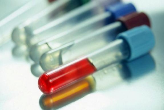 Magyar kutató fedezte fel: összefügg az immunrendszer sokoldalúsága a kórokozók sokféleségével