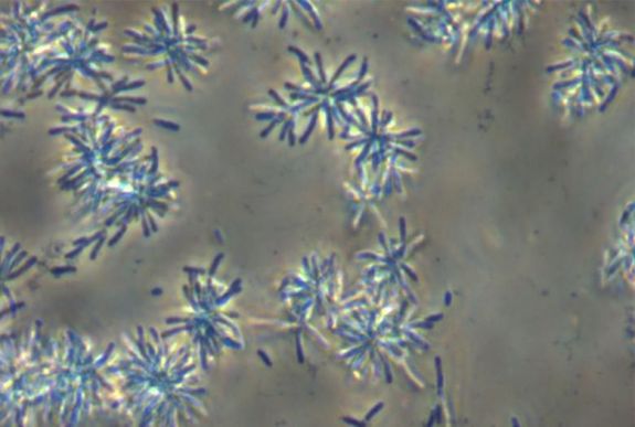 „Székelybacillust” írtak le a Szent Anna-tóból a Sapientia és az ELTE kutatói