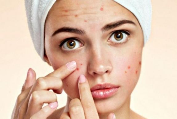 Pattanások elleni harc: minden az étrenddel kezdődik