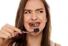 Károsak lehetnek a népszerű szenes fogkrémek