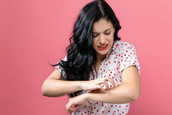 Három házi praktika, hogy gyorsabban elmúljon a szúnyogcsípés