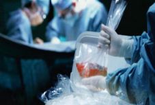 Húsz ukrán adta el illegálisan a veséjét Kazahsztánban