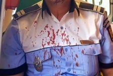 Úgy megütöttek egy rendőrt a zetelaki községházán, hogy kórházba került