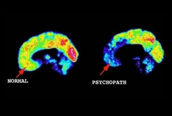 Cătălina Dumitrescu klinikai szakpszichológus: pszichopaták mindig is léteztek, nem a modern kor „termékei” 