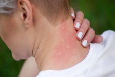 Három hónap alatt három embert ölt meg a nyugat-nílusi vírus Romániában