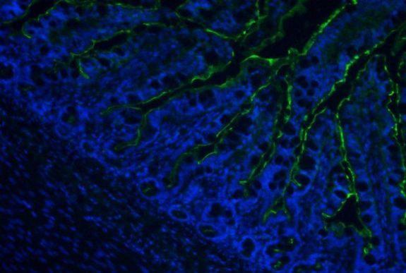 Szökőárral érkezett a halálos trópusi gomba