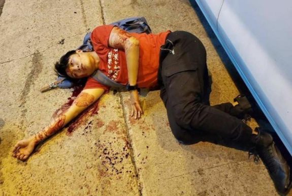 Ismét erőszakos támadás áldozatává vált Hongkongban egy demokratapárti vezető