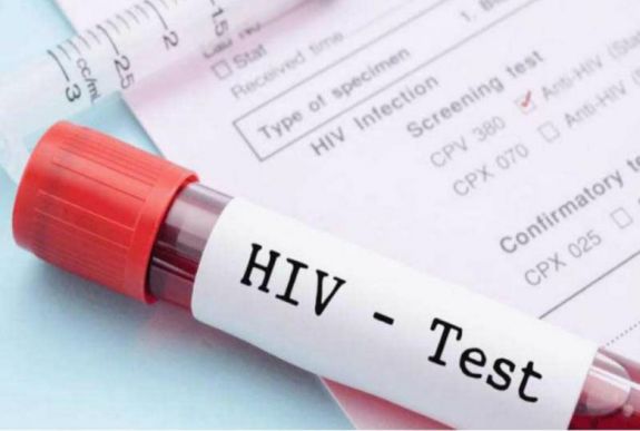 A HIV-vírus egy ritka törzsét azonosították amerikai kutatók