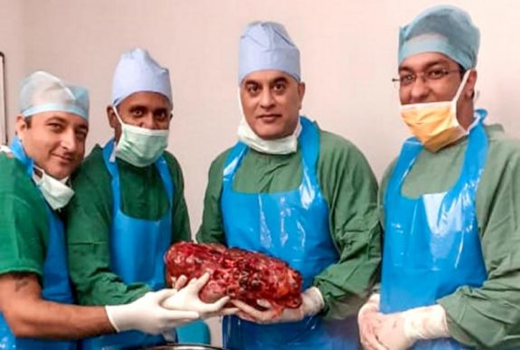 Több mint 7 kilogrammos vesét operáltak ki indiai orvosok