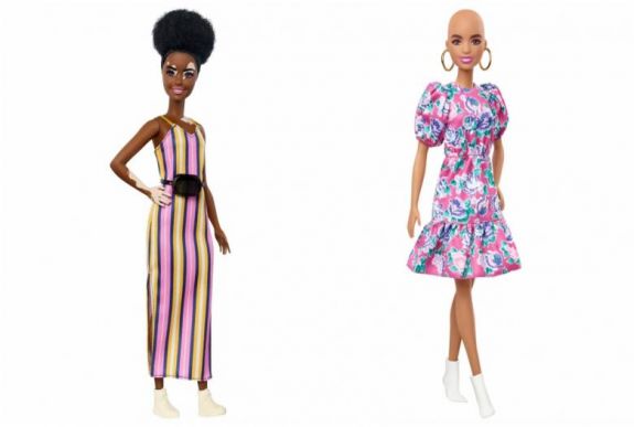 Bőrbeteg és haj nélküli Barbie babát dobtak piacra