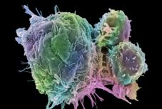 A legtöbb rákot meggyógyíthatja egy frissen felfedezett eljárás