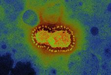 Ausztrál kutatóknak elsőként sikerült előállítaniuk a koronavírust