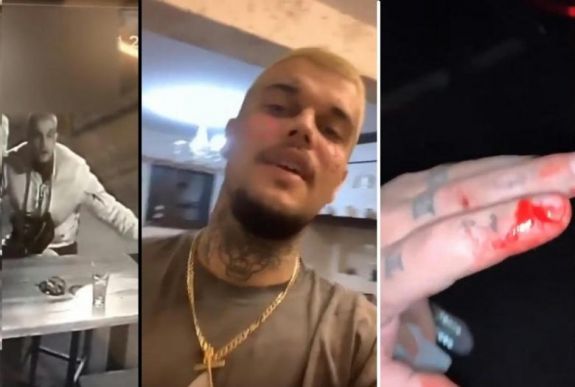 Az erdélyieket gyalázta egy magyarországi rapper, akit állítása szerint megvertek Székelyudvarhelyen